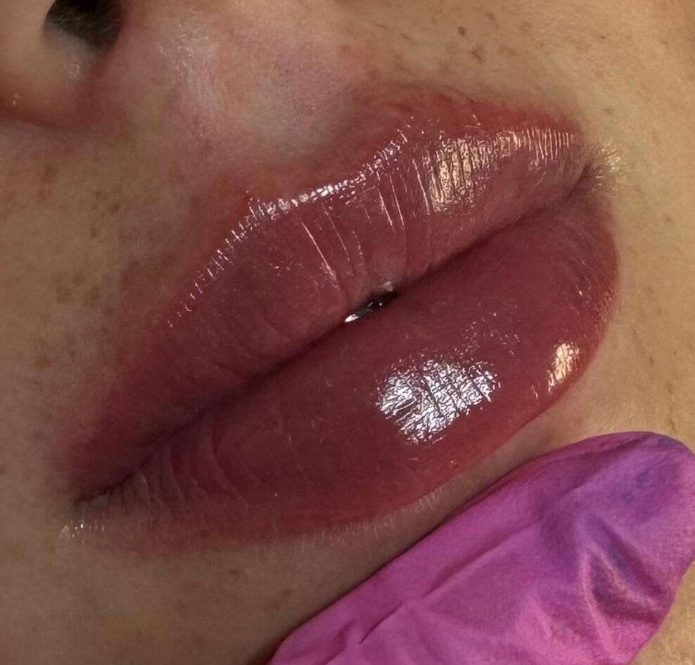 powiększanie ust modelowanie ust